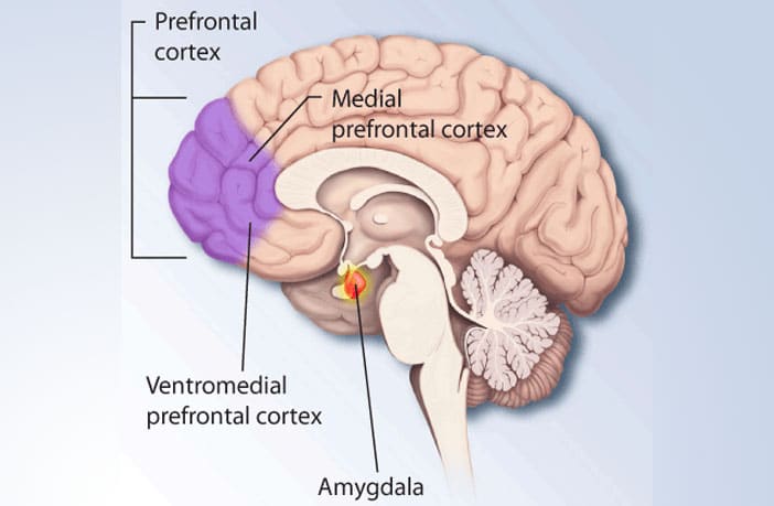 Diagram of a human brain in side view with the prefrontal cortex highlighted in purple and the medial prefrontal cortex, ventromedial prefrontal cortex, and amygdala labeled.